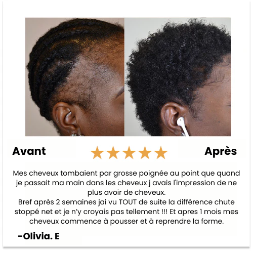 PURE BATANA - Boostez la croissance de vos cheveux