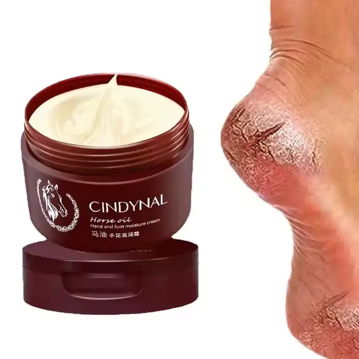 Crème Miracle CINDYNAL – Pieds Doux en 3 Jours (1 acheté = 1 OFFERT🎁 )