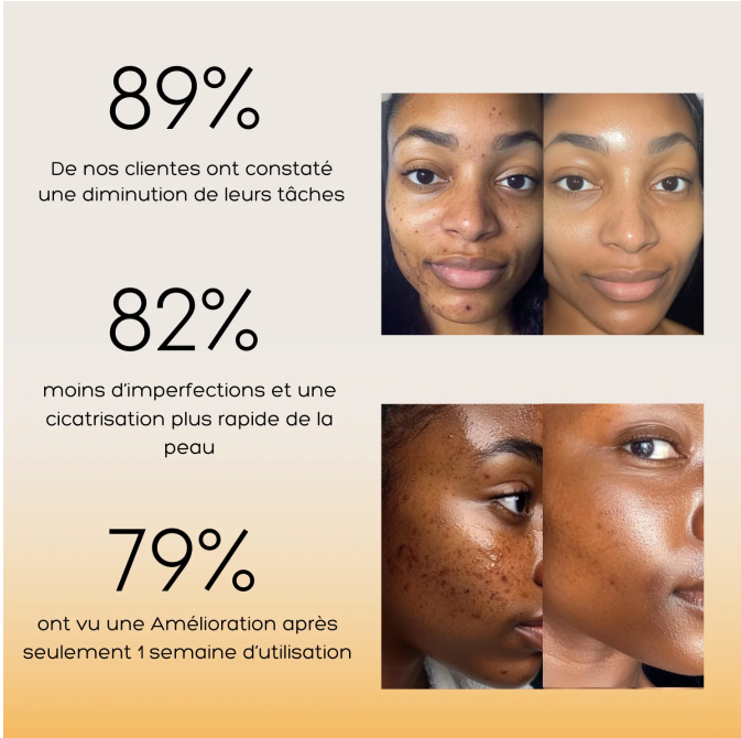 MOIKA™ Cotons Nettoyants à l’Acide Kojique & au Curcuma (50 cotons)