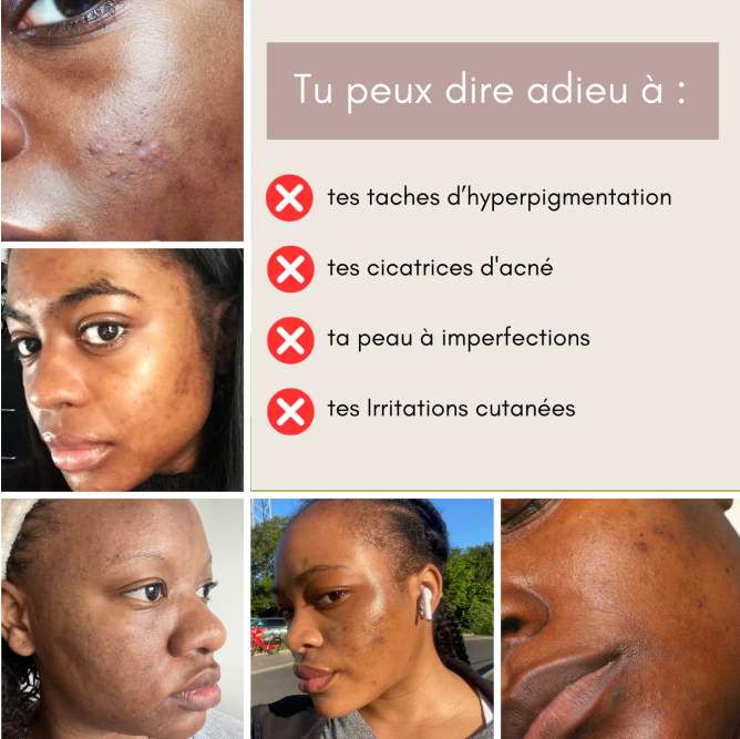 MOIKA™ Cotons Nettoyants à l’Acide Kojique & au Curcuma (50 cotons)