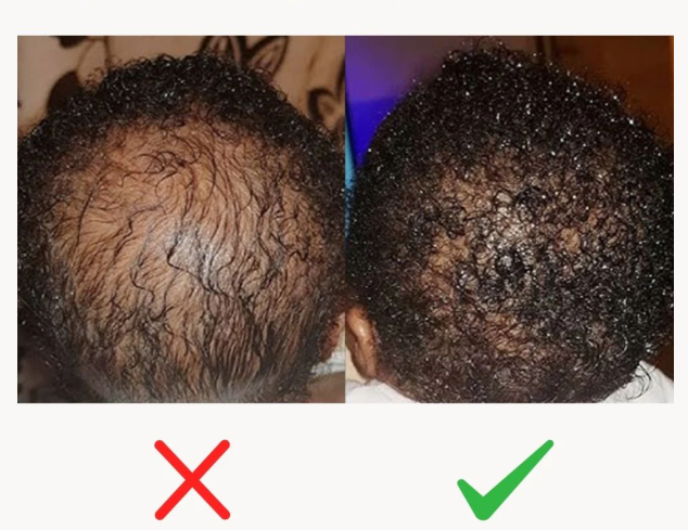 😍Pure Batana - Boostez la croissance de vos cheveux en quelque semaines