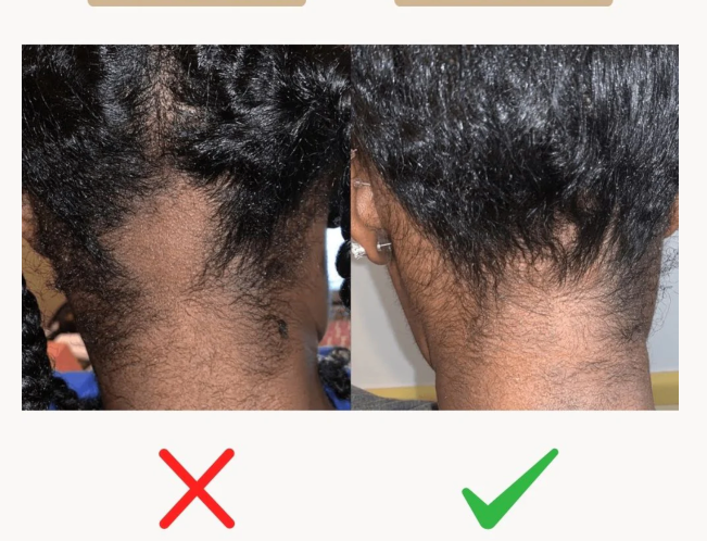 😍Pure Batana - Boostez la croissance de vos cheveux en quelque semaines