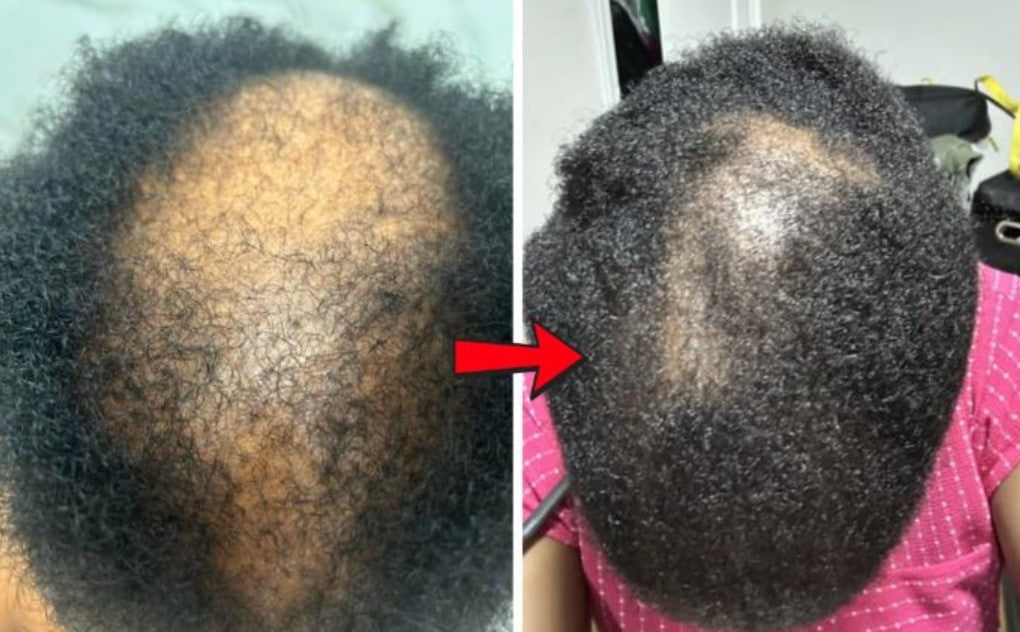 😍Pure Batana - Boostez la croissance de vos cheveux en quelque semaines !